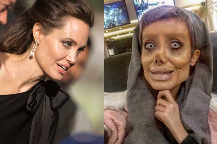 Ze onderging al tientallen operaties om op Angelina Jolie te lijken. Het resultaat? Hmm… (foto’s)