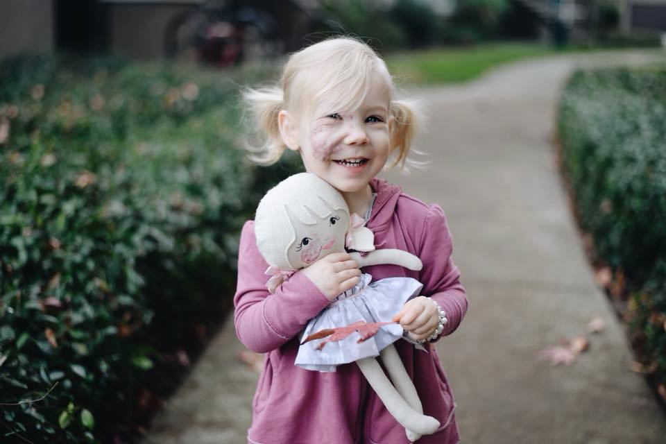 Moeder maakt pop met moedervlek om dochter te steunen