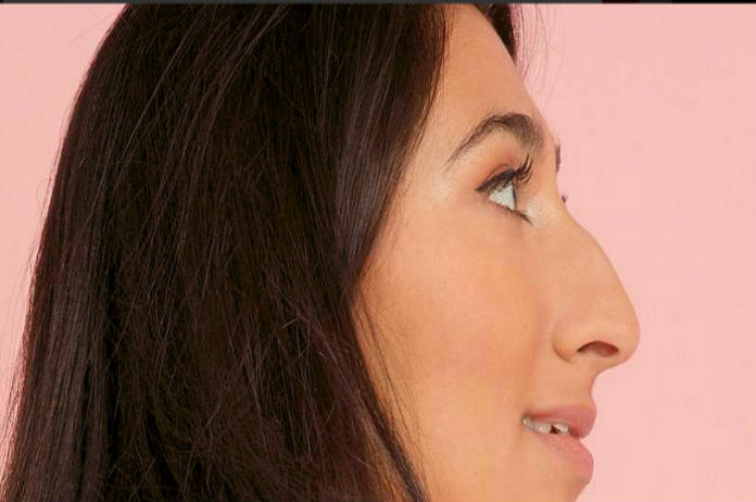 Zijdelingse selfie moet taboe van grote neuzen doorbreken