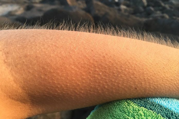 Kippenvel krijgen is goed voor je humeur