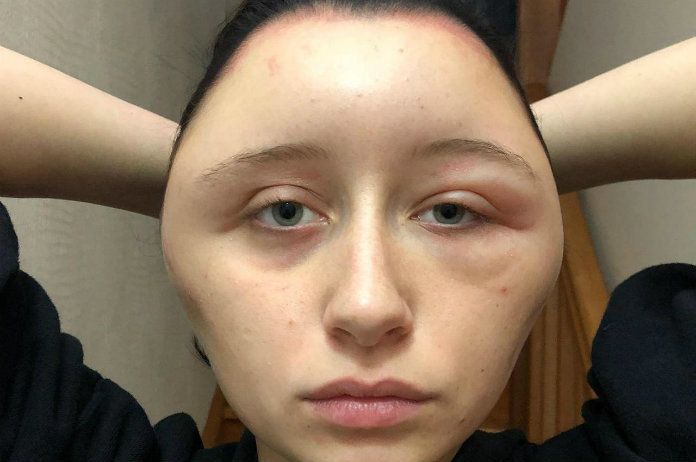 Bizar. Vrouw verft haar, maar dit is niet het resultaat dat ze verwachtte