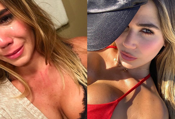 Twee jaar lang werd dit model mishandeld door haar ex. Nu kan ze eindelijk haar verhaal doen. (foto’s)