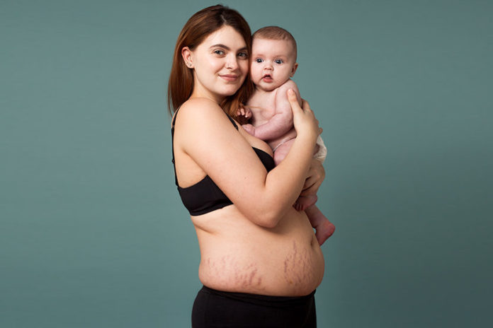IN BEELD. Eerlijke beelden van vrouwen na hun bevalling