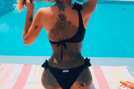 Vrouw met enorme moedervlek over rug en buik geeft pesters lik op stuk