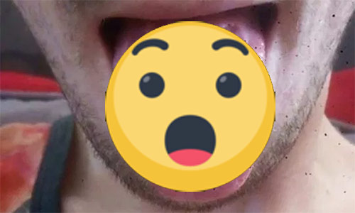 SCHOKKEND: “Dit is wat 6 energiedrankjes per dag drinken met mijn TONG heeft gedaan” (foto)