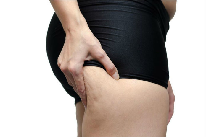 Zo ga je de strijd aan met cellulite