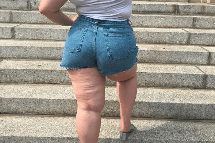 De hashtag #celluLIT maakt geen pu(n)t van cellulitis