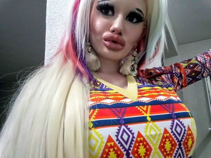 BIZAR. Bulgaarse studente wil de grootste lippen ter wereld: “Dit is mode in Bulgarije”