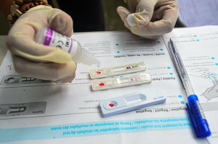 Genezing aids komt stap dichterbij: hiv-restvirus gelokaliseerd