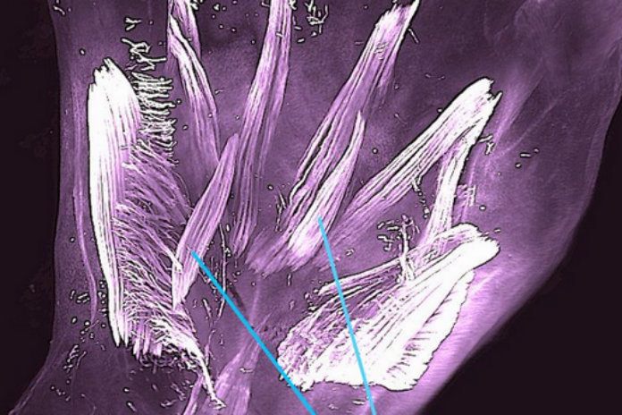 Ongeboren baby’s hebben ‘hagedisachtige’ spiertjes in hand