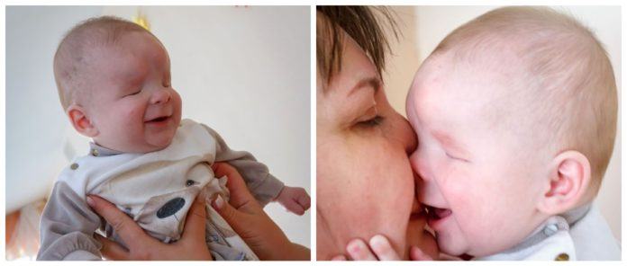Baby die zonder ogen werd geboren zoekt een nieuwe familie