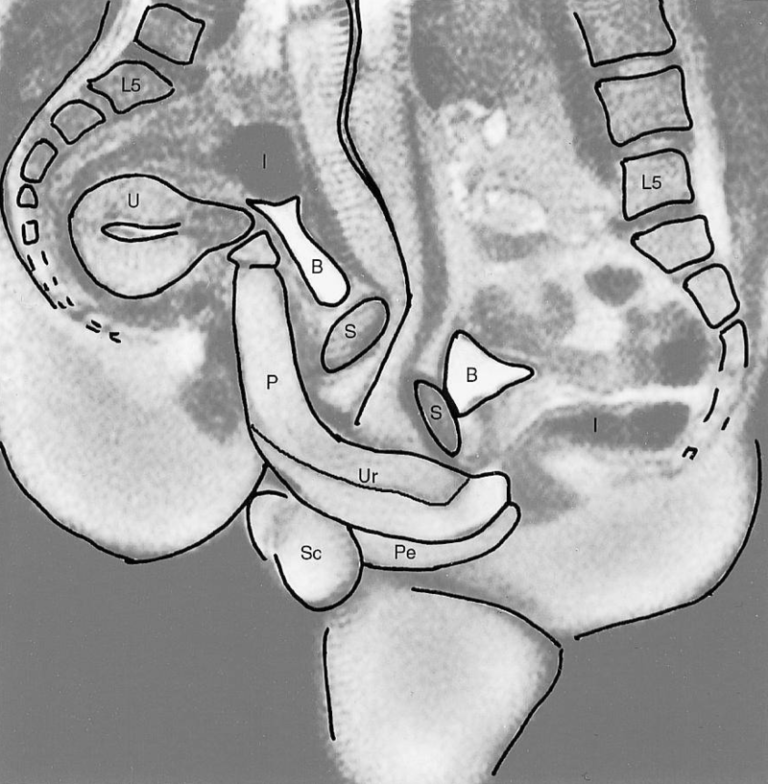 Studie met eerste MRI-scan van vrijend koppel is nog steeds populair: “gratis seksfoto’s werken”