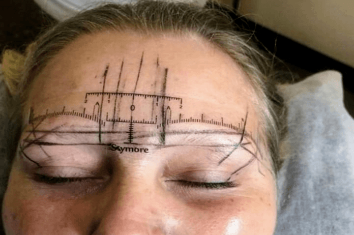 Vrouw doet er alles aan om ‘monsterwenkbrauwen’ te verbergen nadat ingreep fout gaat