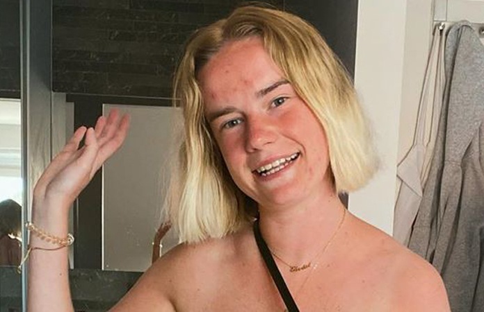 Vlaamse influencer zet haar onvolmaaktheden in de kijker: “De meeste mannen zijn hier niet klaar voor”
