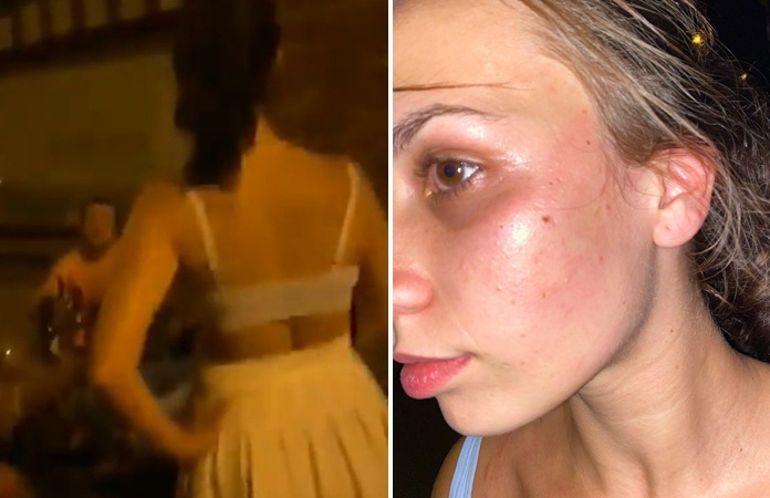 Gentse studente geslagen in café nadat ze aangesproken wordt op haar “te blote” outfit (video)