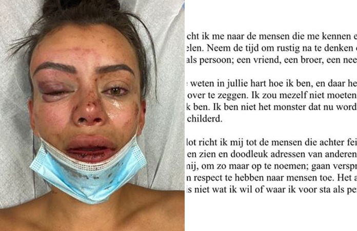 Man die ‘Temptation’-Yasmine in elkaar sloeg, reageert: “Ik ben geen monster”