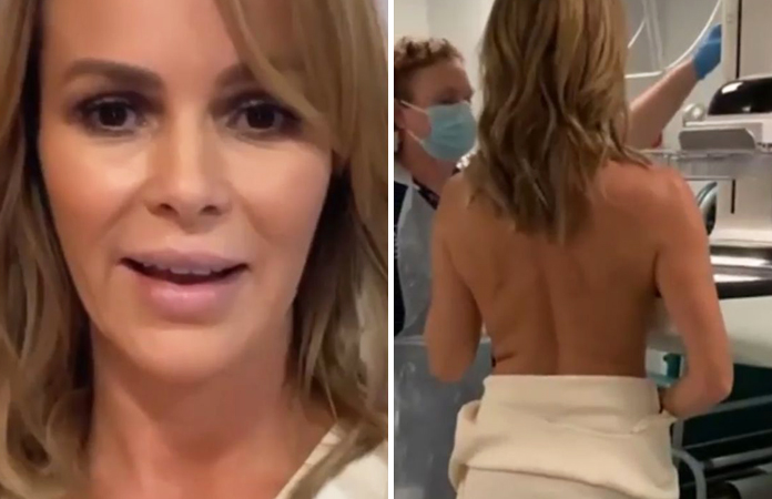 ‘BGT’-jurylid Amanda Holden filmt eigen borstonderzoek: “Hoop dat dit vrouwen kan inspireren” (video)
