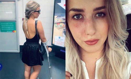 Laura uit ‘Blind Getrouwd’ BETRAPT door haar dokter: “Ik had gezegd dat je dat NIET mocht doen” (foto’s)