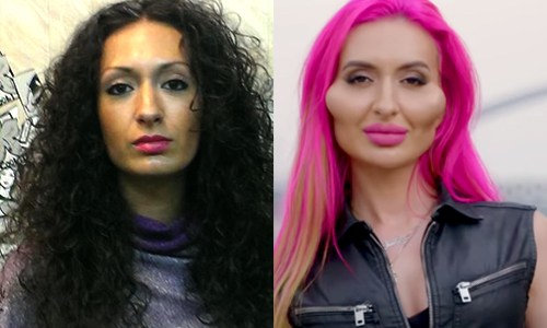 Dame met ‘grootste wangen ter wereld’: “Vroeger was ik lelijk!” (video)