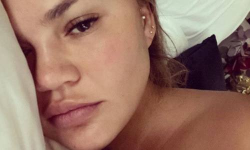 Amerikaans model doet wenkbrauwen fronsen bij fans na rare pose: “Net een kikker” (foto)