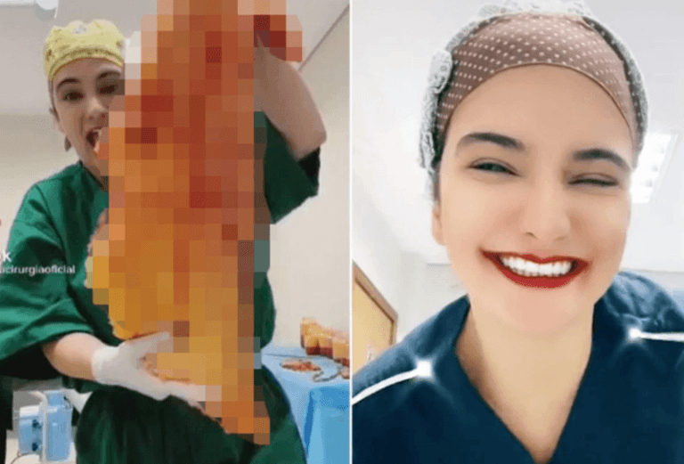 WTF. Plastisch chirurg onder vuur omdat ze ‘danst’ met menselijk vlees en vet (video)