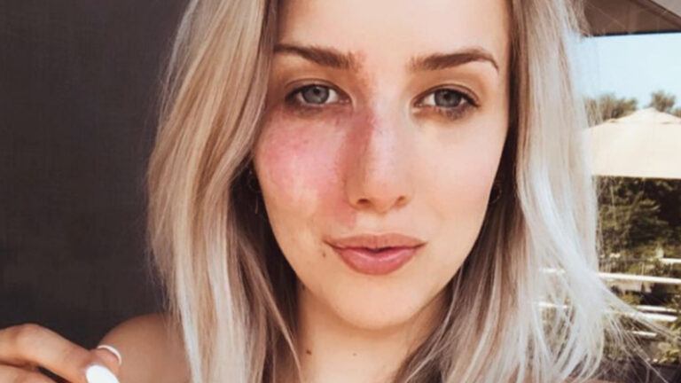 Laura Lieckens (Blind Getrouwd) straalt zonder make-up in bikini: “I love it” (foto)