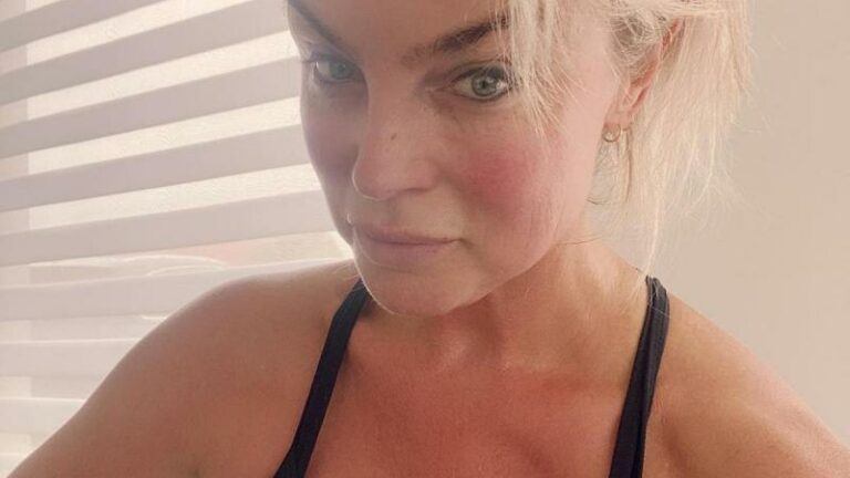 Joyce De Troch laat haar cellulitis verwijderen: «Zo gelukkig met het resultaat!» (foto’s)