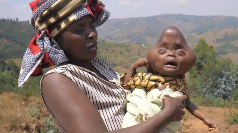 VRESELIJK! Man vraagt zijn vrouw om hun misvormd kind te doden: «Hij is des duivels»