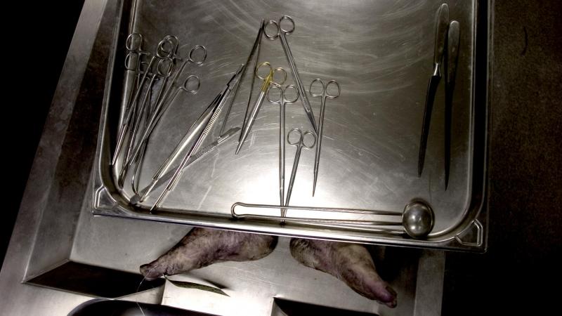 BIZAR. Lichaam van coronadode voor livepubliek gedissecteerd in balzaal van hotel, familie wist van niets (video)