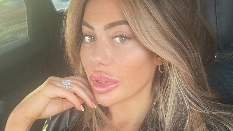 Realityster Chloe Ferry toont littekens op borsten. Fans lovend: “Ze laat tenminste de realiteit zien” (foto)