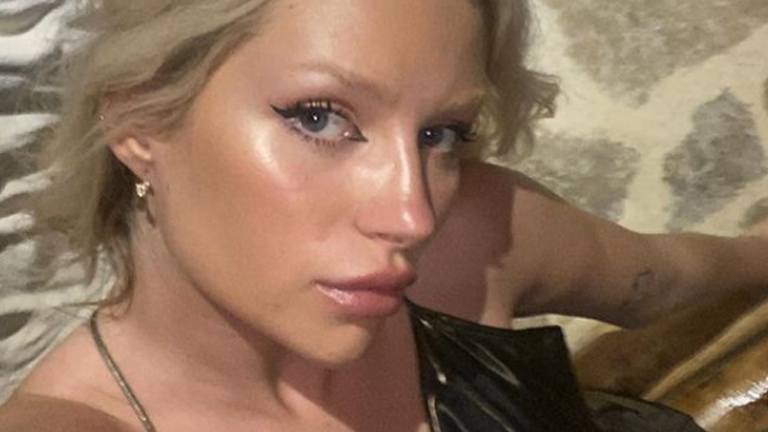 Zus van Kate Moss poseert halfnaakt: “Je lijkt Pamela Anderson wel!” (foto’s)