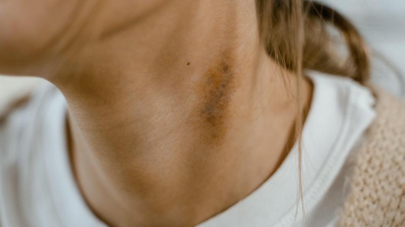 Zo kom je snel van een zuigzoen af