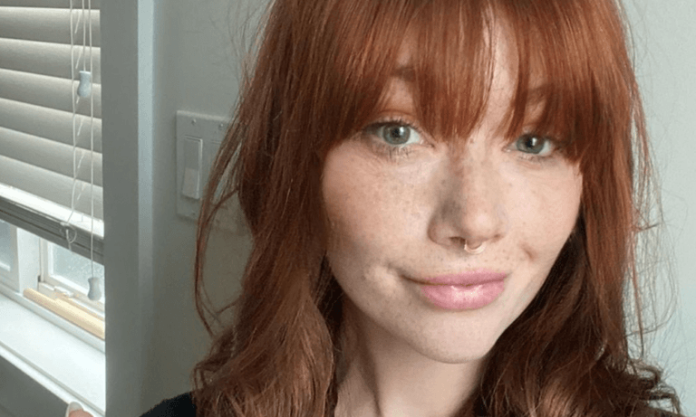 Seksmodel met stoma vertelt over haar beperking: “Staat mijn performance niet in de weg” (foto’s)