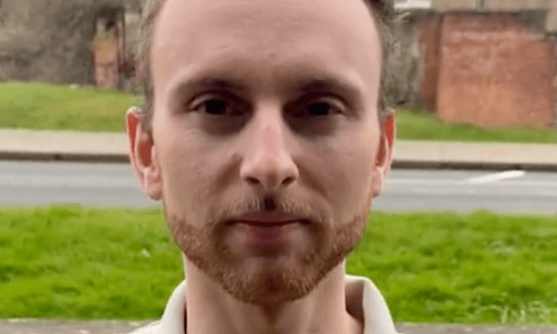 Kalende man barst in tranen uit wanneer hij nieuw haar krijgt: “Ik ben zo gelukkig nu!” (video)