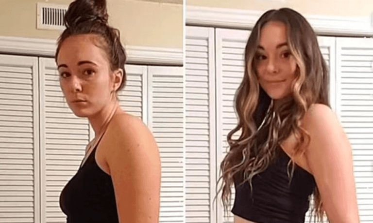 Model bewijst: “Op deze manier faken influencers hun ‘gewichtsverlies’ op foto’s en filmpjes!” (foto’s)