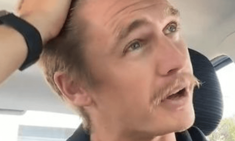 Kalende kerel zegt dat zijn haar weer in volle glorie groeide om deze BIZARRE reden (video)