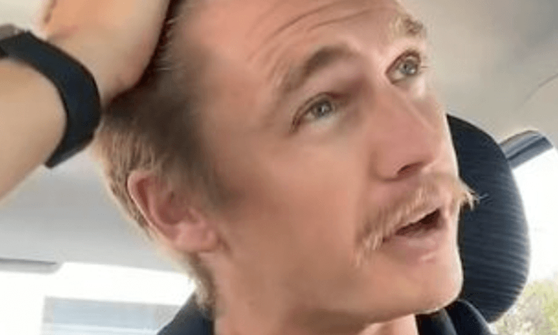 Kalende kerel zegt dat zijn haar weer in volle glorie groeide om deze BIZARRE reden (video)