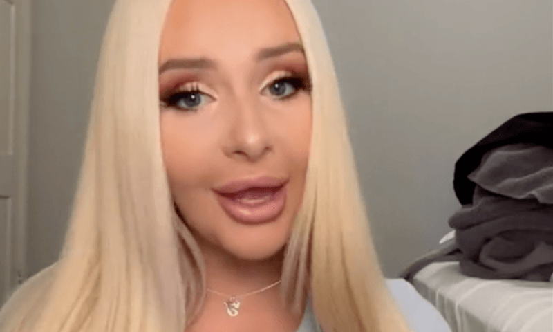 Vrouw geeft 80.000 euro uit aan plastische chirurgie: “Zonder die investering zou ik nu in een McDonald’s werken” (video)