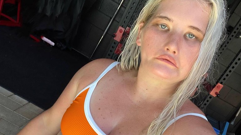 Model dat door aandoening niet kan lachen openhartig: “Ik werd op school altijd gepest” (foto’s)