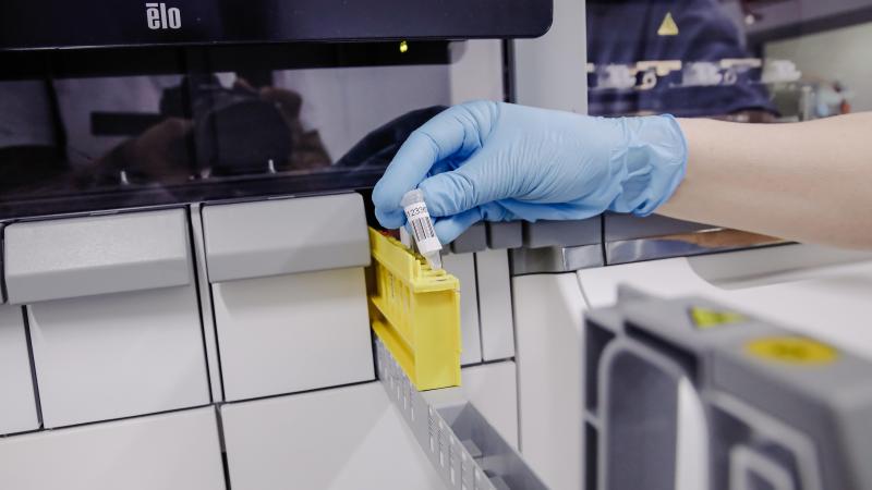 APENPOKKEN. 224 besmettingen met apenpokkenvirus vastgesteld in België