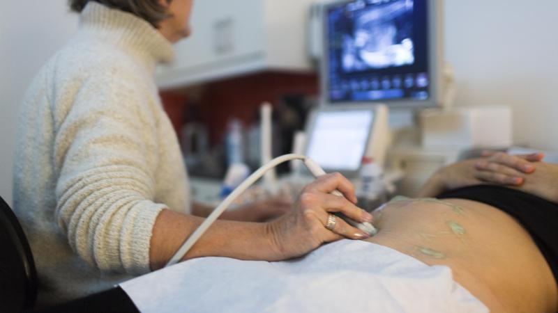 BIZAR. Amerikanen in Georgia kunnen embryo’s van hun belastingen aftrekken