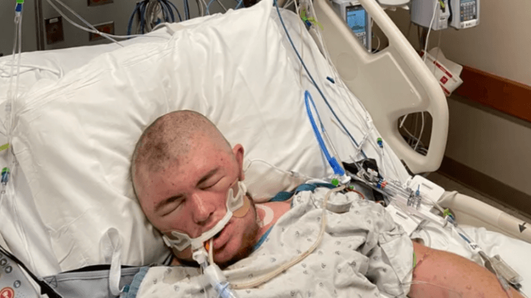WOW. Man ontwaakt uit coma nadat hij 20.000 keer gestoken werd door ‘killer bees’ (foto’s)