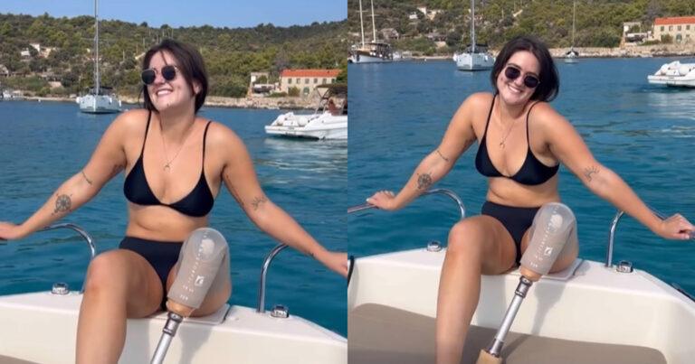 Dame met beenprothese poseert in bikini: “Verberg je lichaam niet!” (foto’s)