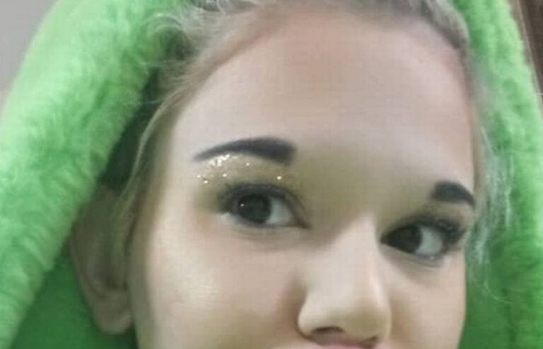 “Ik heb de grootste lippen ter wereld en kan maar niet stoppen om ze nóg te vergroten” (foto’s)