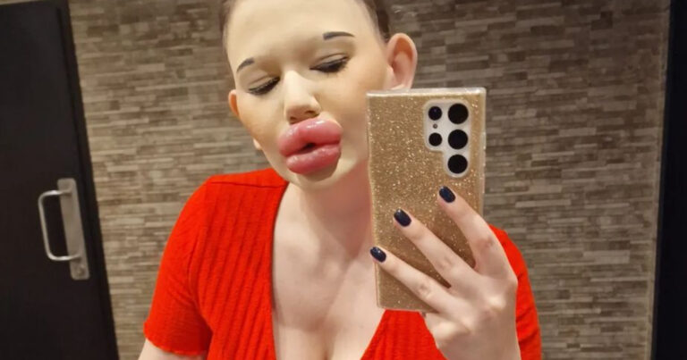 Een kus van de vrouw met de grootste lippen ter wereld? Dat kan! Als je de veiling wint… (foto’s)