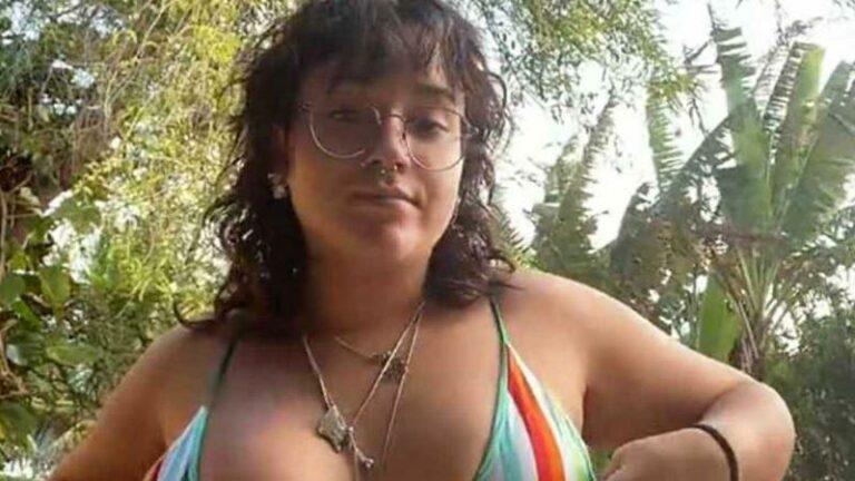 Vrouw wiens ene borst veel groter is dan de andere poseert in bikini: «Eindelijk iemand zoals mij!»