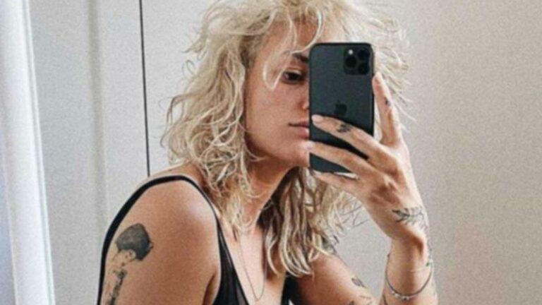 Jitske Van de Veire onderging ooglidcorrectie: «De blauwe plekken neem ik erbij» (foto)