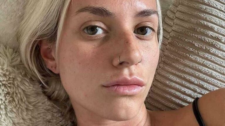 Jitske Van de Veire ondergaat noodzakelijke ingreep: “Beter voorkomen dan genezen” (foto)