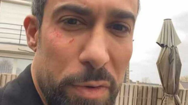 Fabrizio Tzinaridis loopt verwondingen op door storm Ciarán: “Wees extra voorzichtig!” (foto)