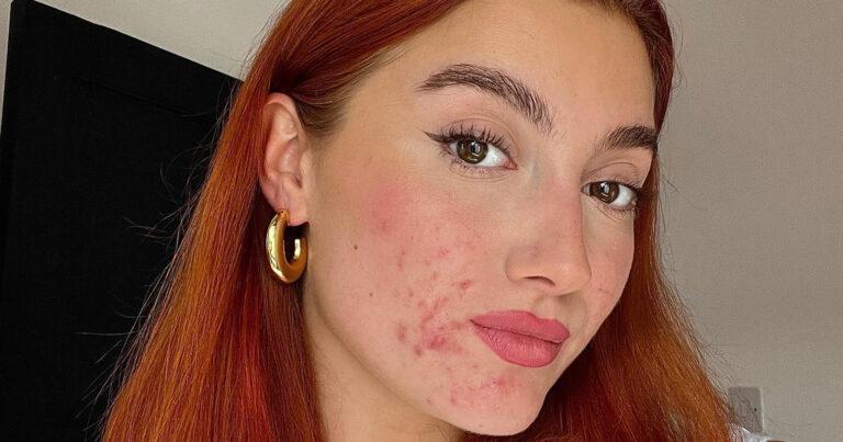 Influencer wil met deze eerlijke naaktfoto’s haar volgers helpen: “Ruwe schoonheid!”